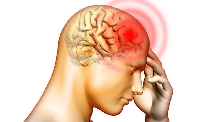 Physical Therapy for headaches